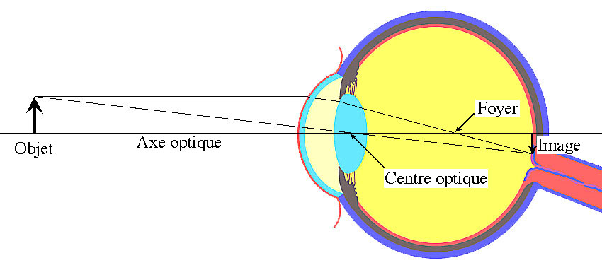 Des gouttes oculaires capables de corriger la réfraction